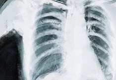 El costo de la inexperiencia en radiología