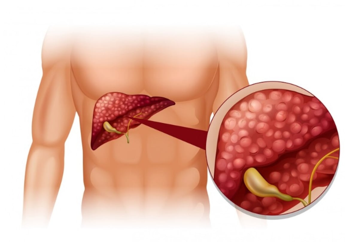 El páncreas tiene una función muy importante en el cuerpo, ya que cumple una función digestiva y endocrina. Ayuda a la digestión de los alimentos y también produce hormonas que regulan los niveles de azúcar en la sangre. (Foto referencial: Freepik)